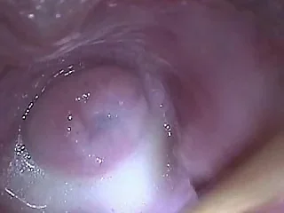 mature tube 0